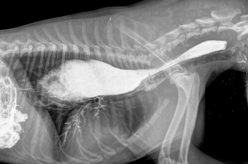 megaezofagus мегаэзофагус